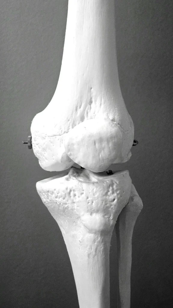 Exploring the Long-Term Effects of Menopause on Bone Health