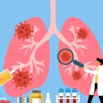 ¿Por qué la investigación contra el cáncer pulmonar no tiene suficiente financiamiento?