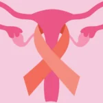Endometrial Most cancers Analysis and Endometrial Most cancers Take a look at