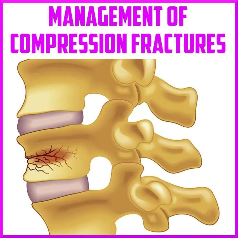 Squeeze A Entire Trade Conserve Into Your Lunch Fracture