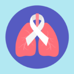 Síntomas de cáncer pulmonar