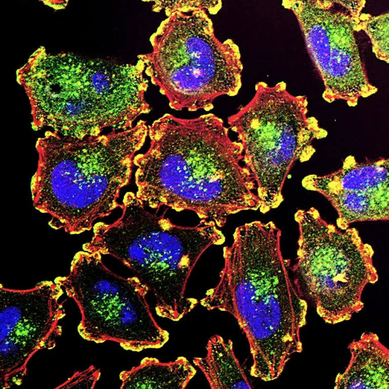 Melanoma metastásico – HealthyWomen Melanoma metastásico – HealthyWomen