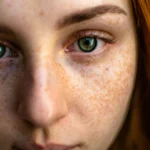 From Acne to Glow: How Keto Can Benefit Your Skin