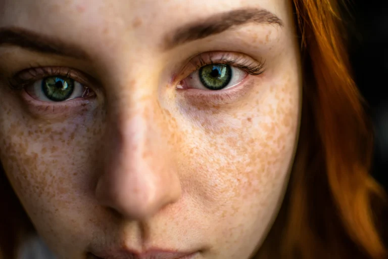 From Acne to Glow: How Keto Can Benefit Your Skin