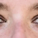 Managing Menopause Dry Eyes: Tips and Treatment Options