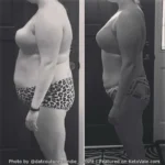 Keto Diet Success Stories: How It’s Changing Lives for Those with Epilepsy